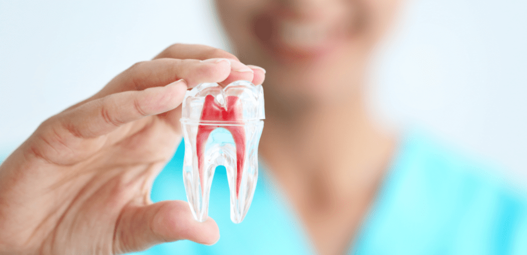 teeth @ w1 - root canal x-ray